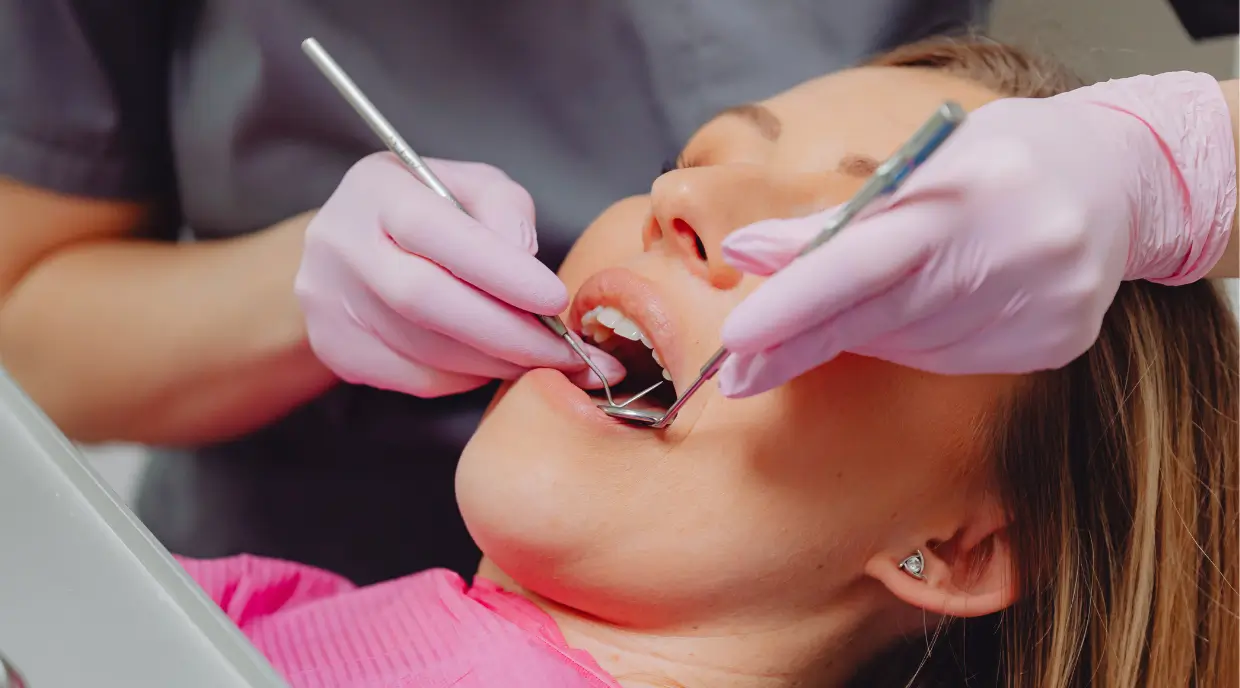 ToothColouredFillings-North-York