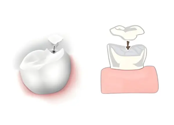 dentist-north-york-dental