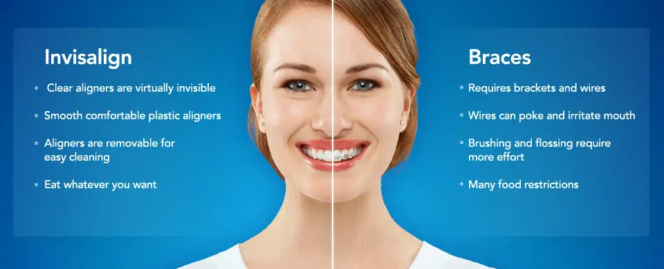 dentist-north-york-invisalign2
