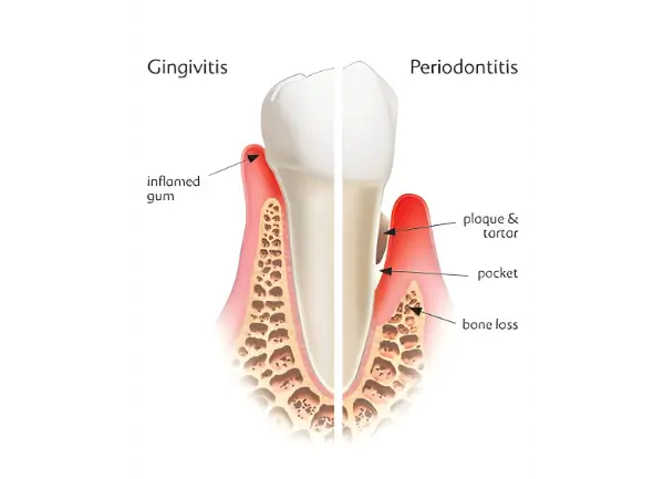 dentist-north-york-toothcrosssectionweb-n