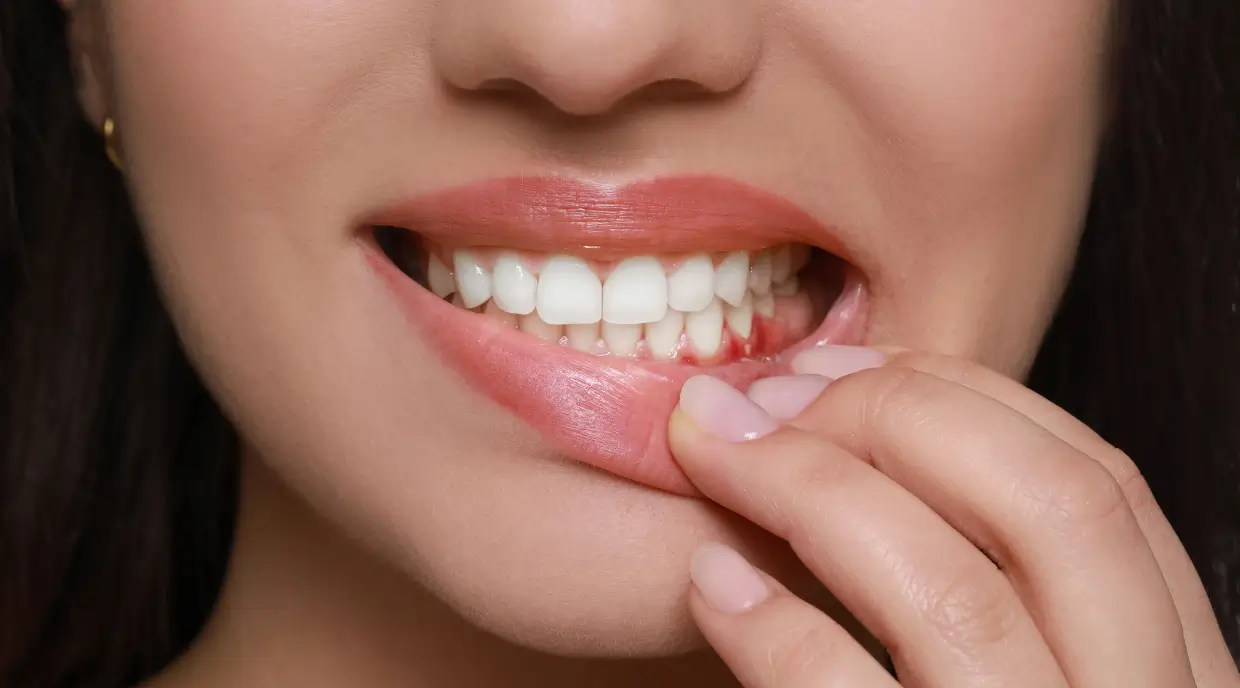 Gum Disease North York Dentist