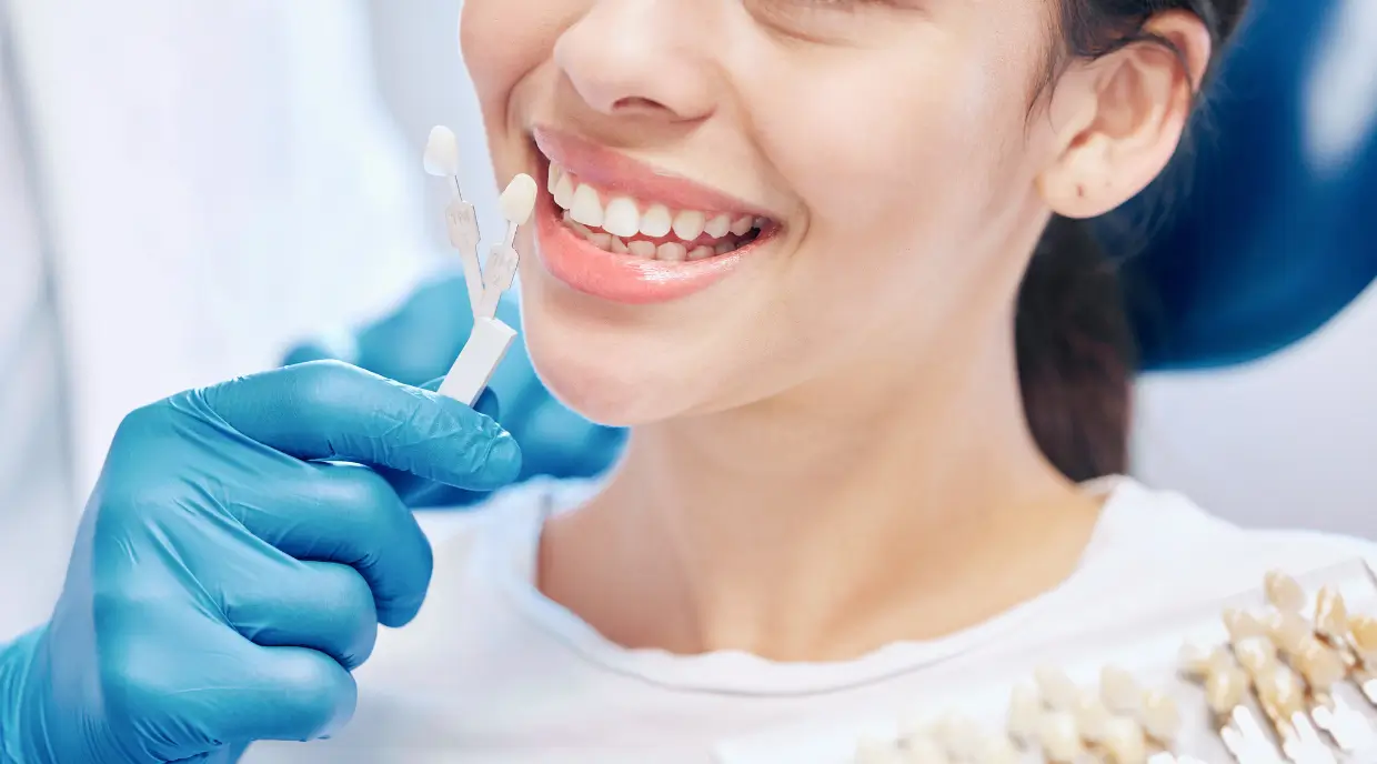 Porcelain Veneers North York
